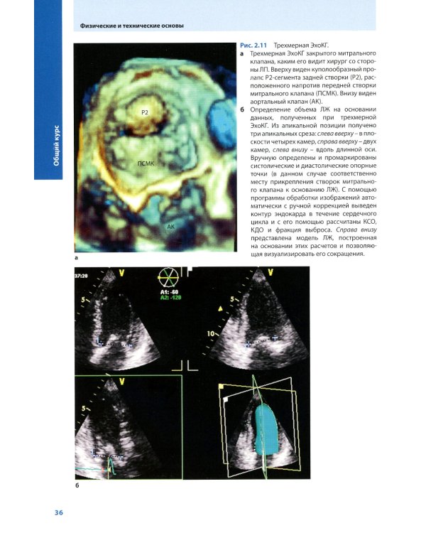 Курс эхокардиографии (+ DVD)
