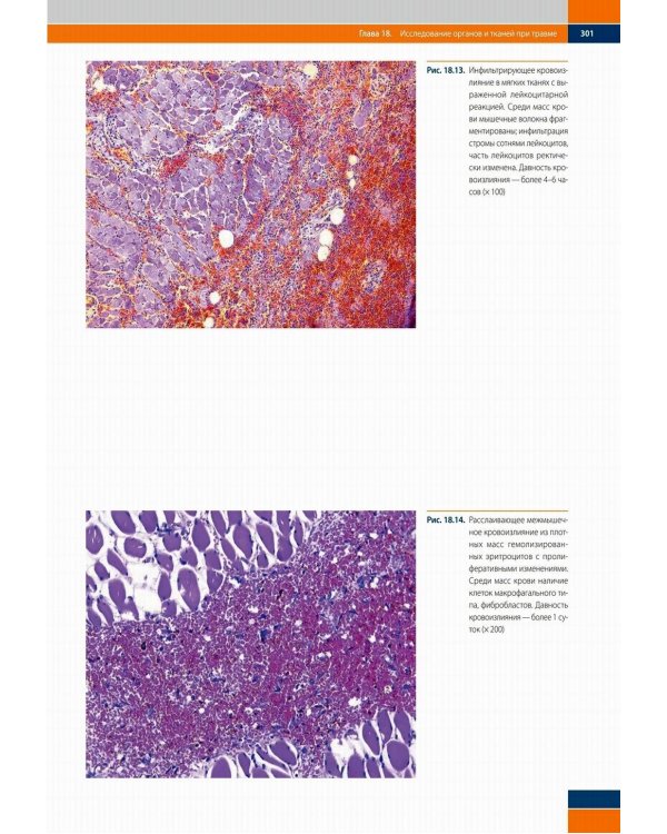 Судебно-медицинская гистология: иллюстрированный алгоритм судебно-гистологического исследования