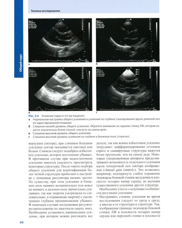 Курс эхокардиографии (+ DVD)