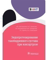 Эндопротезирование тазобедренного сустава при коксартрозе