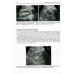 Ультразвуковое исследование в урологии и нефрологии: монография. 4-е изд., стер Ультразвуковое исследование в урологии и нефрологии: монография. 4-е изд., стер
