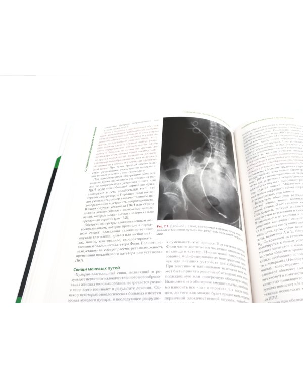 Клиническая онкогинекология. В 3 т. (комплект из 3-х книг)