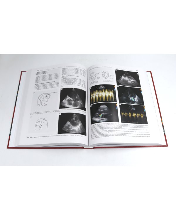 Эхокардиография от М.К. Рыбаковой (комплект из 4-х книг)