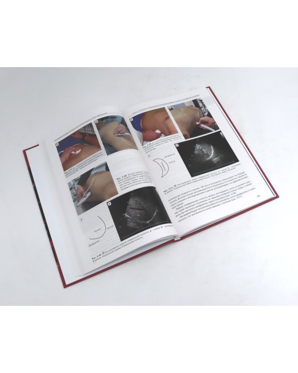 Эхокардиография от М.К. Рыбаковой (комплект из 4-х книг)