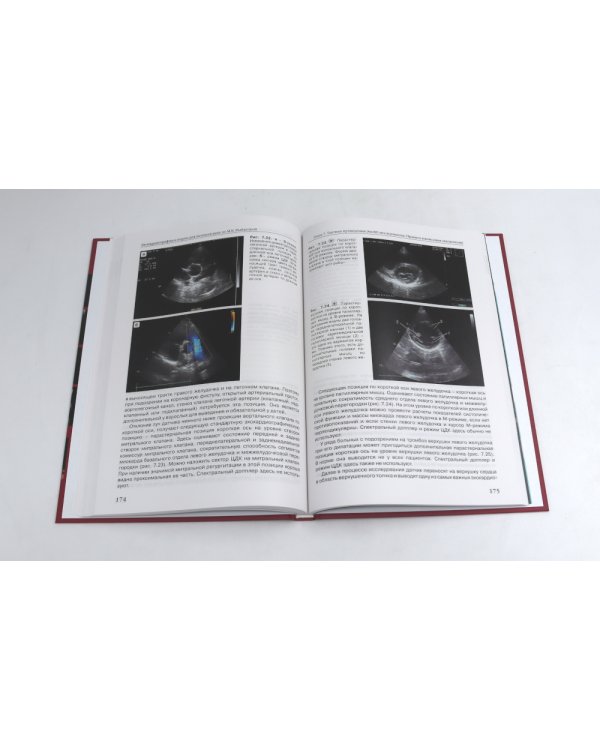 Эхокардиография от М.К. Рыбаковой (комплект из 4-х книг)