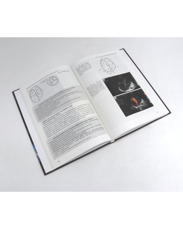 Эхокардиография от М.К. Рыбаковой (комплект из 4-х книг)