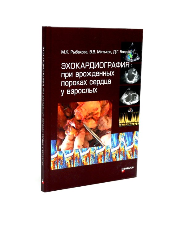 Эхокардиография от М.К. Рыбаковой (комплект из 4-х книг)
