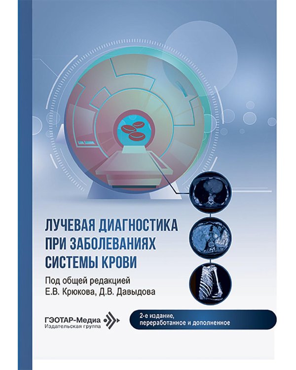 Лучевая диагностика при заболеваниях системы крови . 2-е изд., перераб. и доп