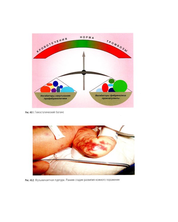Неонатология: национальное руководство. В 2 т. Т. 2. 2-е изд., перераб. и доп