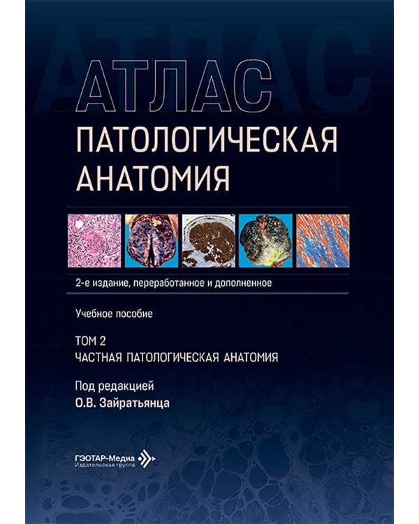 Патологическая анатомия. Атлас. В 2 т. Т. 2: Частная патологическая анатомия: Учебное пособие. 2-е изд., перераб. и доп