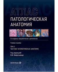 Патологическая анатомия. Атлас. В 2 т. Т. 2: Частная патологическая анатомия: Учебное пособие. 2-е изд., перераб. и доп