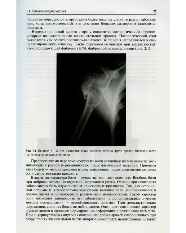 Диагностика и лечение доброкачественных опухолей и опухолеподобных заболеваний костей у детей