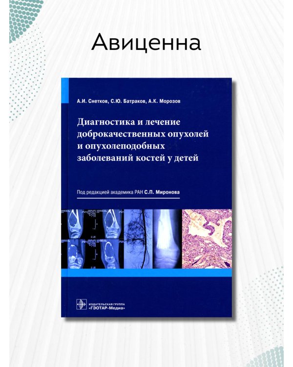 Диагностика и лечение доброкачественных опухолей и опухолеподобных заболеваний костей у детей