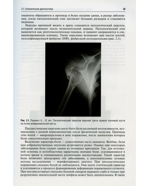 Диагностика и лечение доброкачественных опухолей и опухолеподобных заболеваний костей у детей