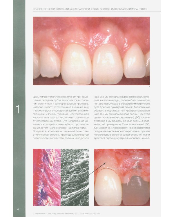 Пластическая хирургия мягких тканей в области имплантов. В 2 т