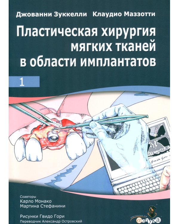 Пластическая хирургия мягких тканей в области имплантов. В 2 т