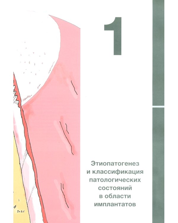 Пластическая хирургия мягких тканей в области имплантов. В 2 т