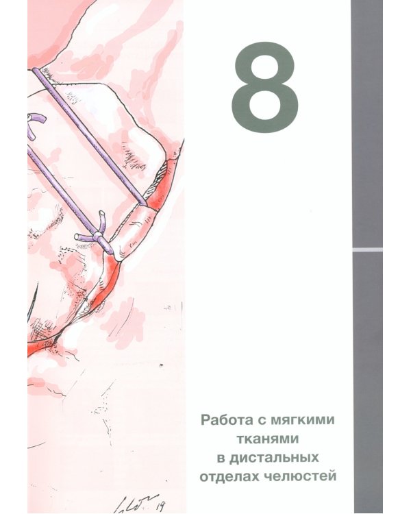 Пластическая хирургия мягких тканей в области имплантов. В 2 т