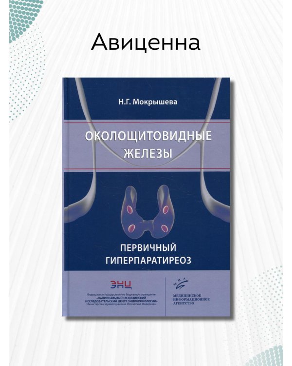 Околощитовидные железы. Первичный гиперпаратиреоз