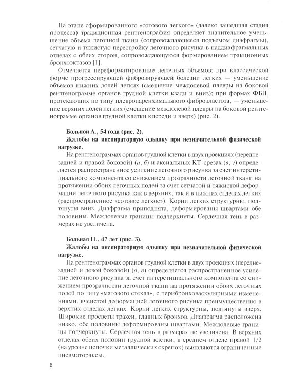 Фиброзирующие болезни легких. Роль рентгенолога в мультидисциплинарном консилиуме