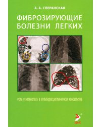 Фиброзирующие болезни легких. Роль рентгенолога в мультидисциплинарном консилиуме