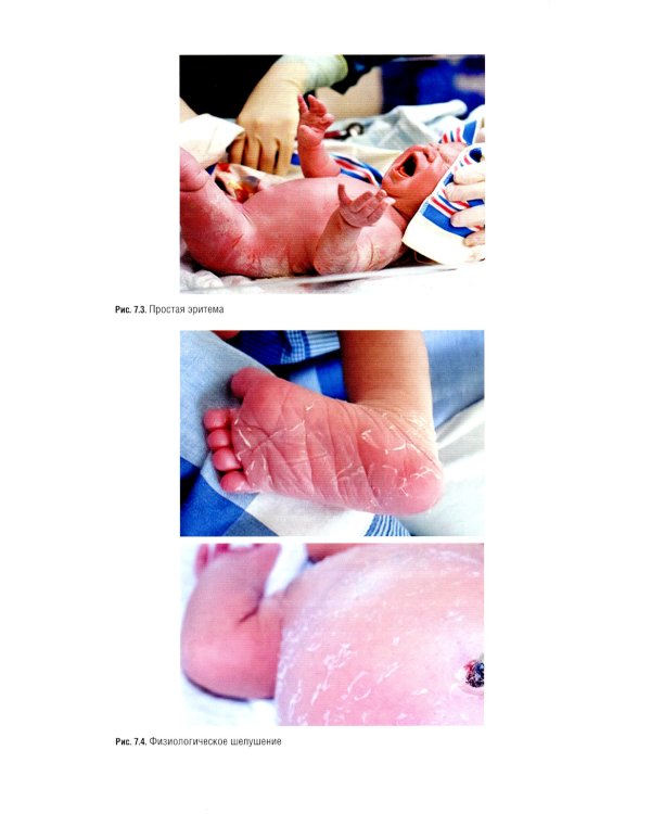 Неонатология: национальное руководство. В 2 т. Т. 1. 2-е изд., перераб. и доп