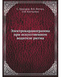 Электрокардиограмма при искусственном водителе ритма