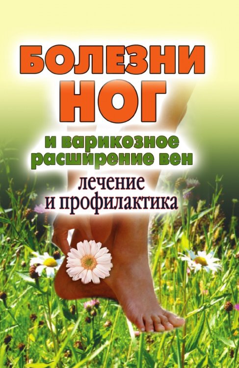 Болезни ног и варикозное расширение вен. Лечение и профилактика
