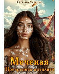 Меченая. Презренная витилиго.