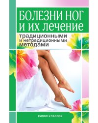 Болезни ног и их лечение традиционными и нетрадиционными методами