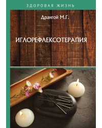 Иглорефлексотерапия