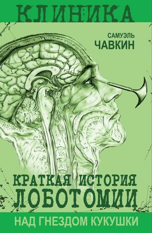 Обложка книги «Над гнездом кукушки. Краткая история лоботомии» — Чавкин Самуэль, ISBN 9785002694914