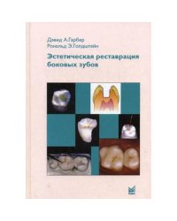 Эстетическая реставрация боковых зубов