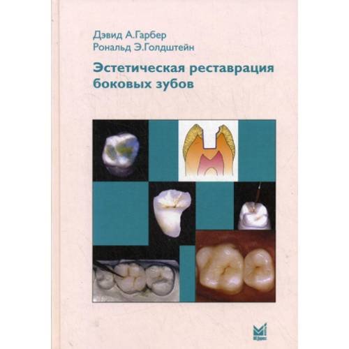 Обложка книги «Эстетическая реставрация боковых зубов» — Гарбер Дэвид А.;Голдштейн Рональд Э., ISBN 5983224840