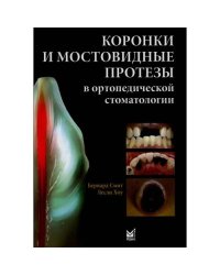 Коронки и мостовидные протезы в ортопедической стоматологии