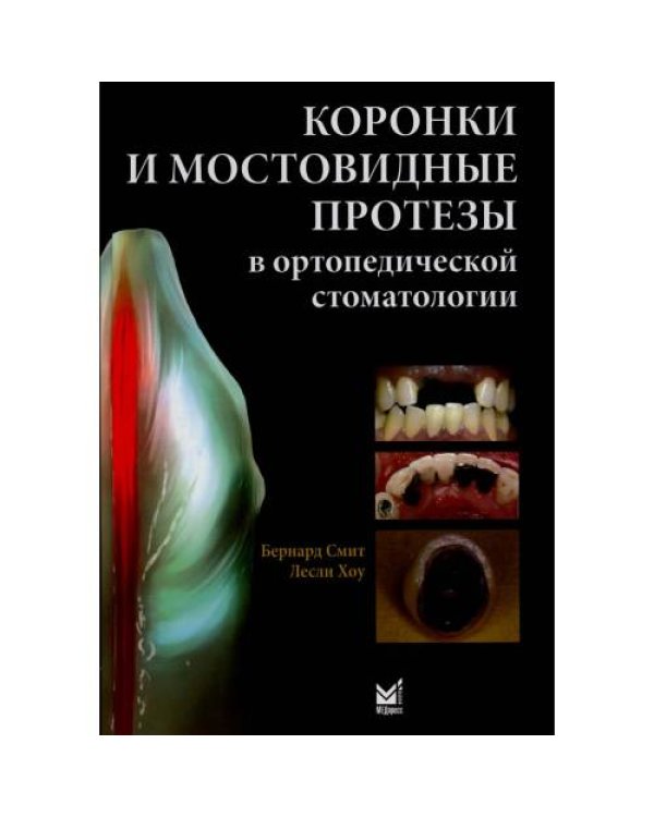 Дополнительное изображение книги «Коронки и мостовидные протезы в ортопедической стоматологии»