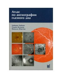 Атлас по ангиографии глазного дна