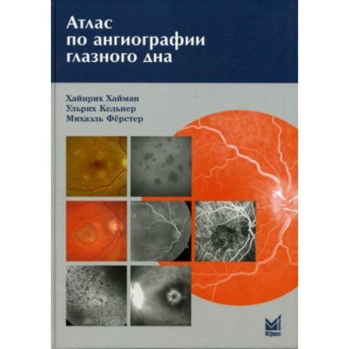 Обложка книги «Атлас по ангиографии глазного дна» — Хайман Хайнрих;Кельнер Ульрих;Ферстер Михаель, ISBN 5983223844