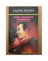 Тайна сиамских близнецов