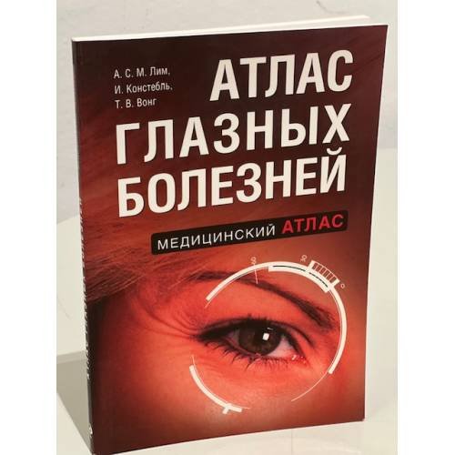 Атлас глазных болезней
