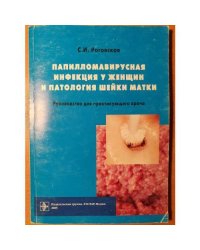 Папилломавирусная инфекция у женщин и патология шейки матки: в помощь практикующему врачу