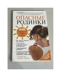 Опасные родинки