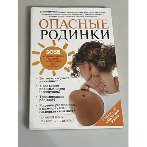 Опасные родинки