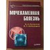 Мочекаменная болезнь