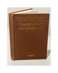Лимфэдема конечностей