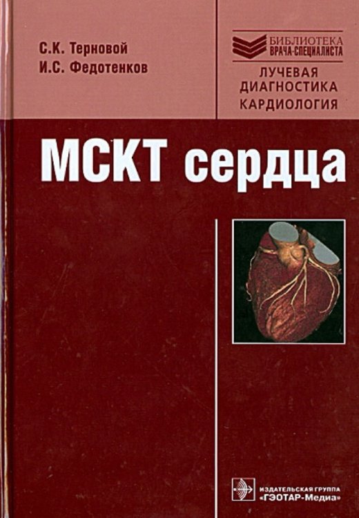 Обложка книги «МСКТ сердца» — Терновой Сергей Константинович, Федотенков Игорь Сергеевич, ISBN 9785970426852