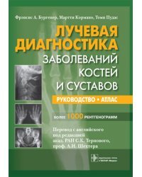 Лучевая диагностика заболеваний костей и суставов. Руководство