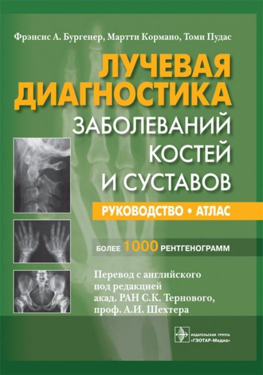 Лучевая диагностика заболеваний костей и суставов. Руководство