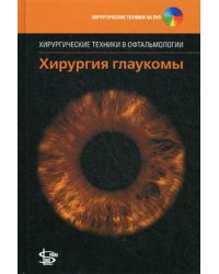 Хирургия глаукомы (+ DVD)