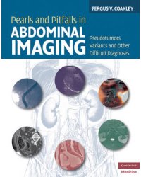 Pearls and Pitfalls in Abdominal Imaging. Pseudotumors, Variants and Other Difficult Diagnoses